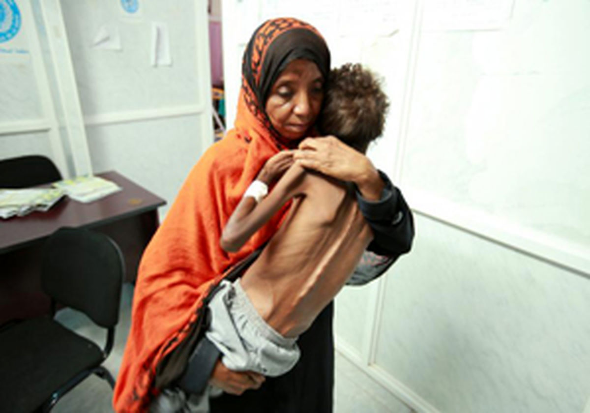 یونیسف: کودکان یمنی در شرایطی زندگی می‌کنند که هیچ انسانی آن را تحمل نمی‌کند