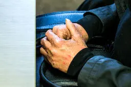 آغاز تدوین سند ملی بیماری‌های نادر