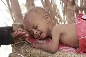 ابتلای نیم میلیون یمنی به وبا همزمان با ادامه جنگ