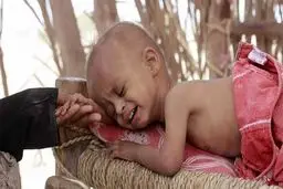 ابتلای نیم میلیون یمنی به وبا همزمان با ادامه جنگ