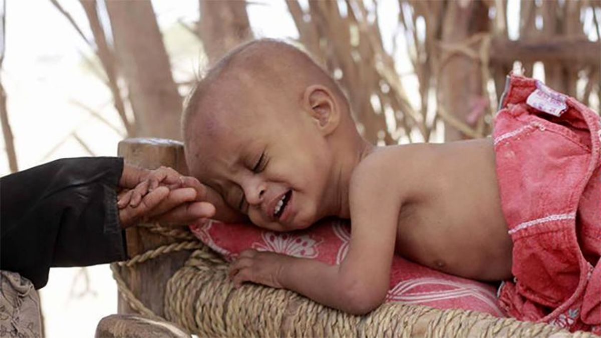 ابتلای نیم میلیون یمنی به وبا همزمان با ادامه جنگ