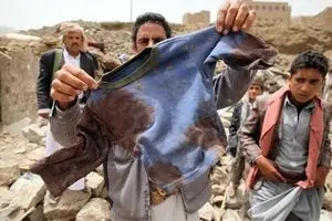 سرپوش سعودی ها بر جنایاتشان در یمن