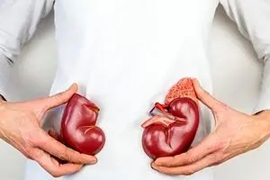 آقایان برای اهدای کلیه بهترند