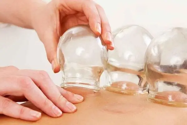 کسب درآمد از انجام حجامت جایز است؟