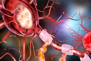 آغاز ساخت حسگری برای تشخیص بیماری آلزایمر