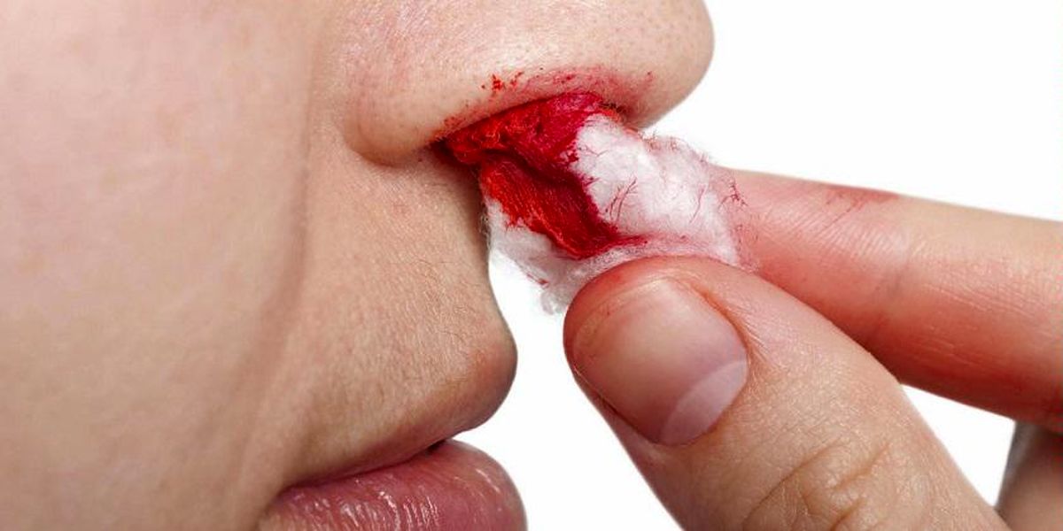خونریزی از دهان و بینی در هنگام وضو باطل کننده است؟