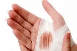 «زخم‌هایی» که می‌تواند بیمار را از پا درآورد