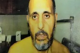 انتشار عکس آثار شکنجه روی بدن اسیری فلسطینی