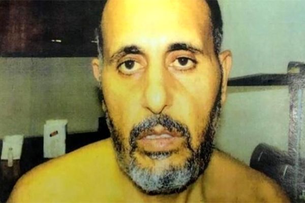 انتشار عکس آثار شکنجه روی بدن اسیری فلسطینی