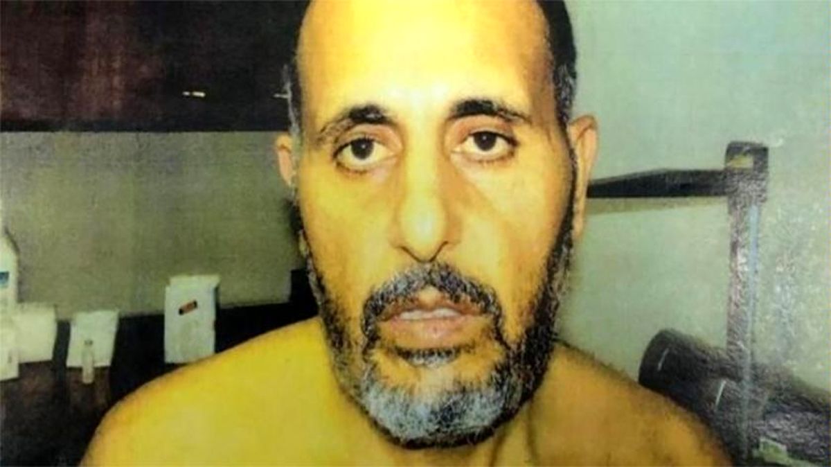 انتشار عکس آثار شکنجه روی بدن اسیری فلسطینی