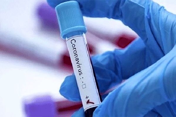 تست مثبت کرونا ویروس در ۲ بیمار فوت شده ساوه‌ای