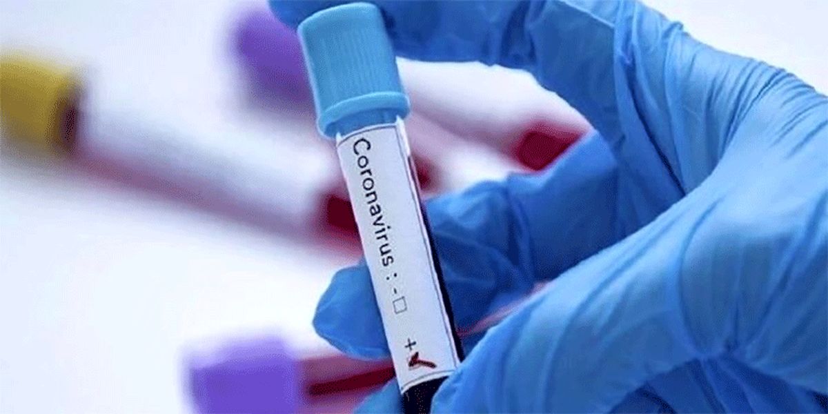 تست مثبت کرونا ویروس در ۲ بیمار فوت شده ساوه‌ای
