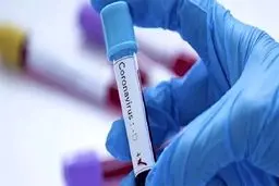 آمار مبتلایان به کرونا در کویت افزایش یافت