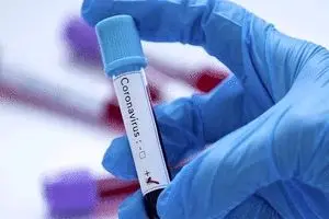 تولید واکسن کرونا توسط یک شرکت بیوتکنولوژی