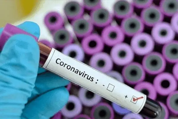 شیوع کرونا در آمریکا با ۲۸ میلیون نفر بدون بیمه فاجعه‌بار است