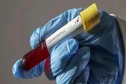 کیت تشخیص کرونا تولید بومی شد