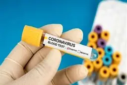 معرفی داروی ضد کرونا، یک سلبریتی را دادگاهی کرد