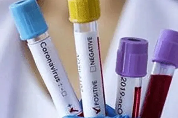 آمار امروز مبتلایان و فوتی‌های کرونا در ایران