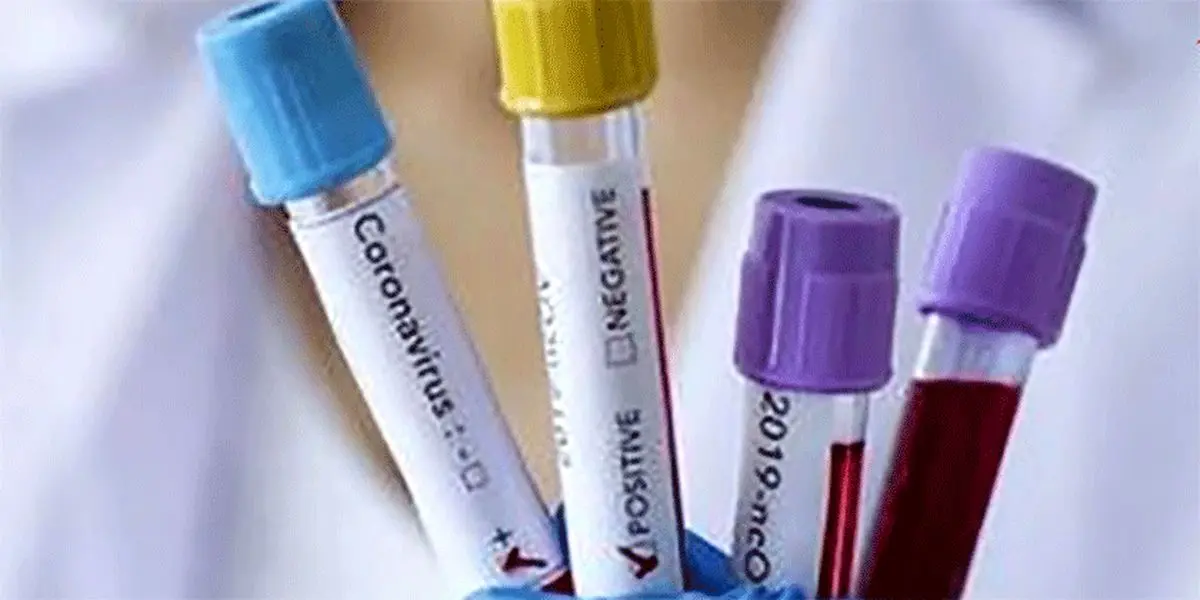 عکس: خیرات بسته بهداشتی برای ختم یک مبتلا به کرونا