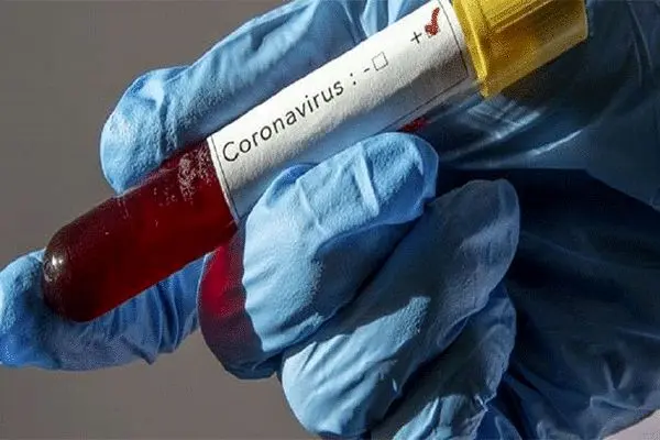 ۲۰ واکسن برای کرونا در حال بررسی است