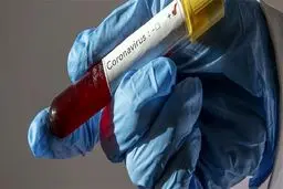 عکس: درگذشت دو پرسنل دیگر از کادر درمان رشت