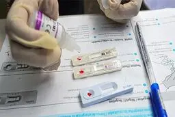 دومین بیمار مبتلا به ایدز درمان شد