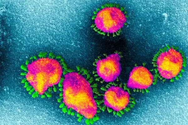 اضطراب کرونا در زنان بیش از مردان