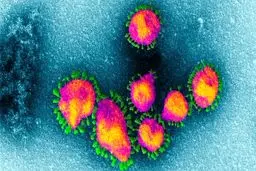 اضطراب کرونا در زنان بیش از مردان