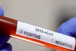 اینفوگرافیک: آمار رسمی مبتلایان کرونا تا روز یکشنبه ۲۵ اسفند ۹۸