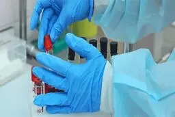 تعداد قربانیان کرونا در انگلیس به ۳۵ نفر رسید