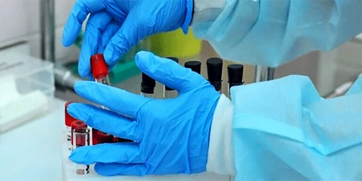 تعداد قربانیان کرونا در انگلیس به ۳۵ نفر رسید