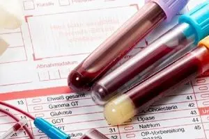 با این آزمایش ساده ۵۰ نوع سرطان شناسایی می‌شود