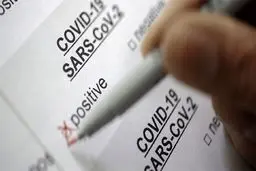 تست کرونا در تهران الزامی نیست