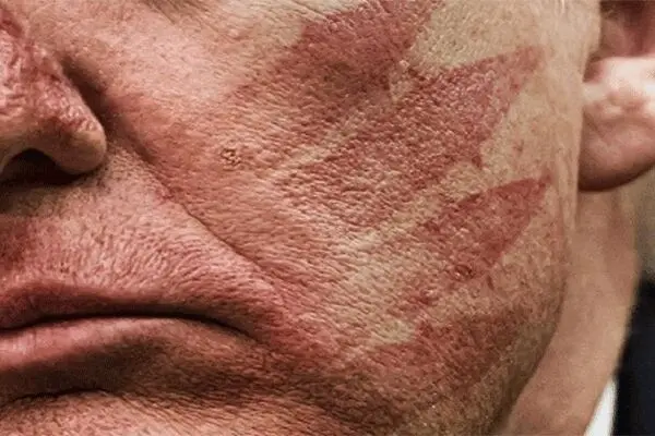 اثر انگشتان ایران بر روی صورت ترامپ