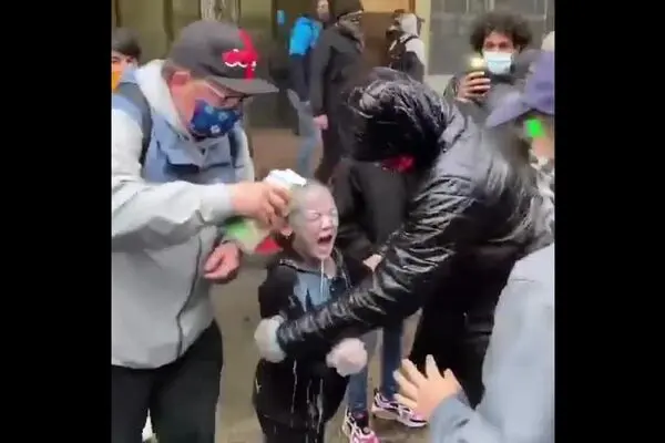 فیلم: اسپری فلفل صورت دختر خردسال آمریکایی را سوزاند