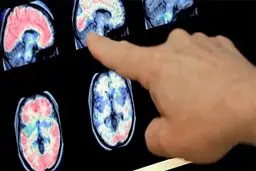 شناسایی ۲۴۴۹ بیمار جدید مبتلا به کرونا