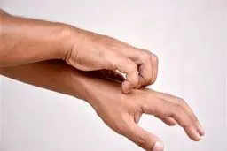 خارش پوست، جدیدترین نشانه ابتلا به کرونا