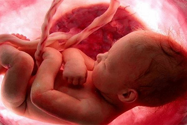 انتقال کرونا از مادر به جنین