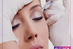 هرآنچه از بوتاکس و لیفت ابرو باید بدانید !