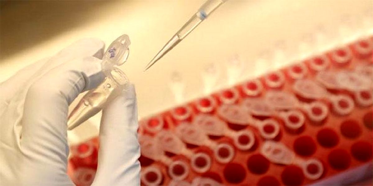 احتمال تزریق گسترده واکسن ایرانی کرونا از مهر ۱۴۰۰