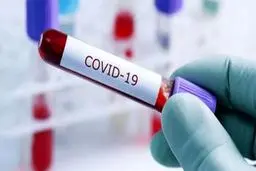 آزمایش جدید کرونا می‌تواند همزمان ۹۱ نفر را تست کند