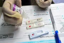 اینفوگرافیک: ایدز را بیشتر بشناسیم