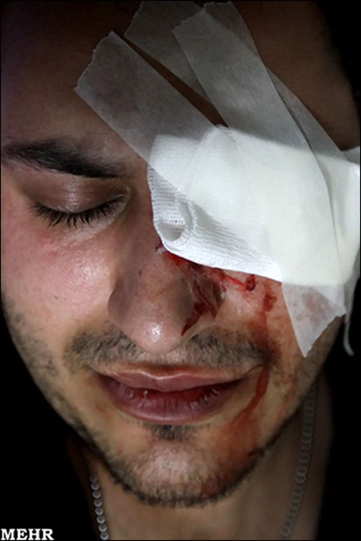 افزایش مراجعین شب چهارشنبه سوری به بیمارستان فارابی