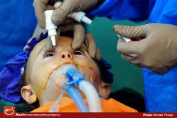 انجام نخستین جراحی شبکیه چشم در بیمارستان میلاد