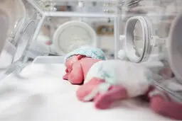 علل مرگ کودکان زیر ۵ سال در پاندمی کووید ۱۹ بررسی شد
