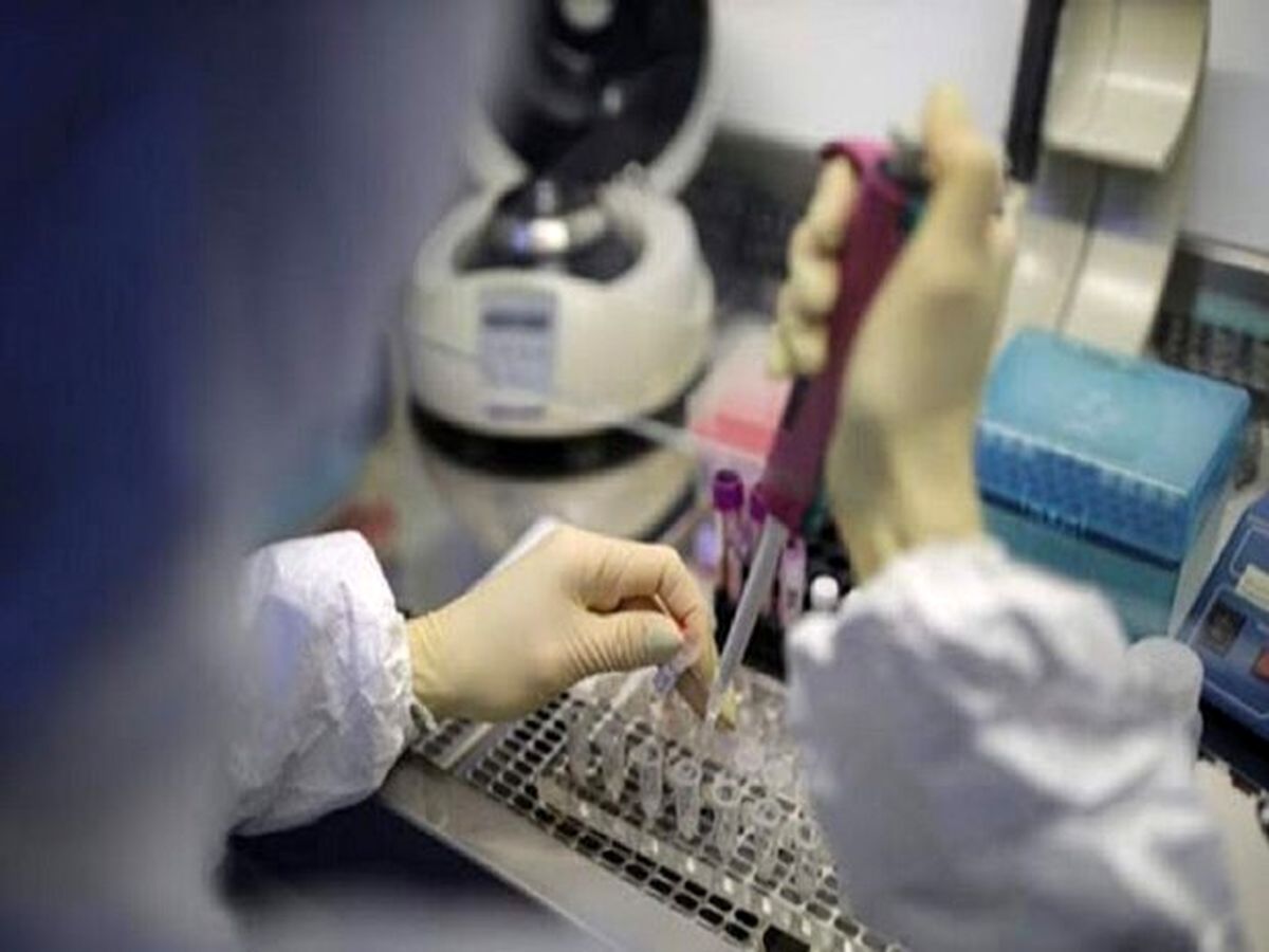 انجام ۴۵۰ هزار تست PCR در استان تهران