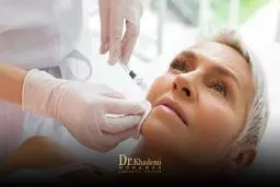 هر آنچه که درباره فیلر خط خنده باید بدانید!