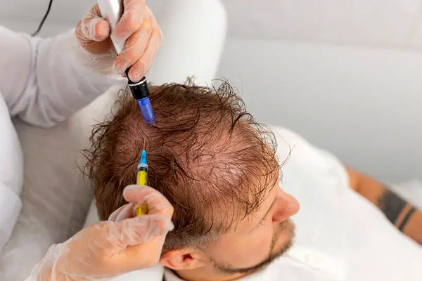 راز رویش دوباره موها با اگزوزوم؛ وقتی علم و زیبایی دست در دست هم می‌دهند 