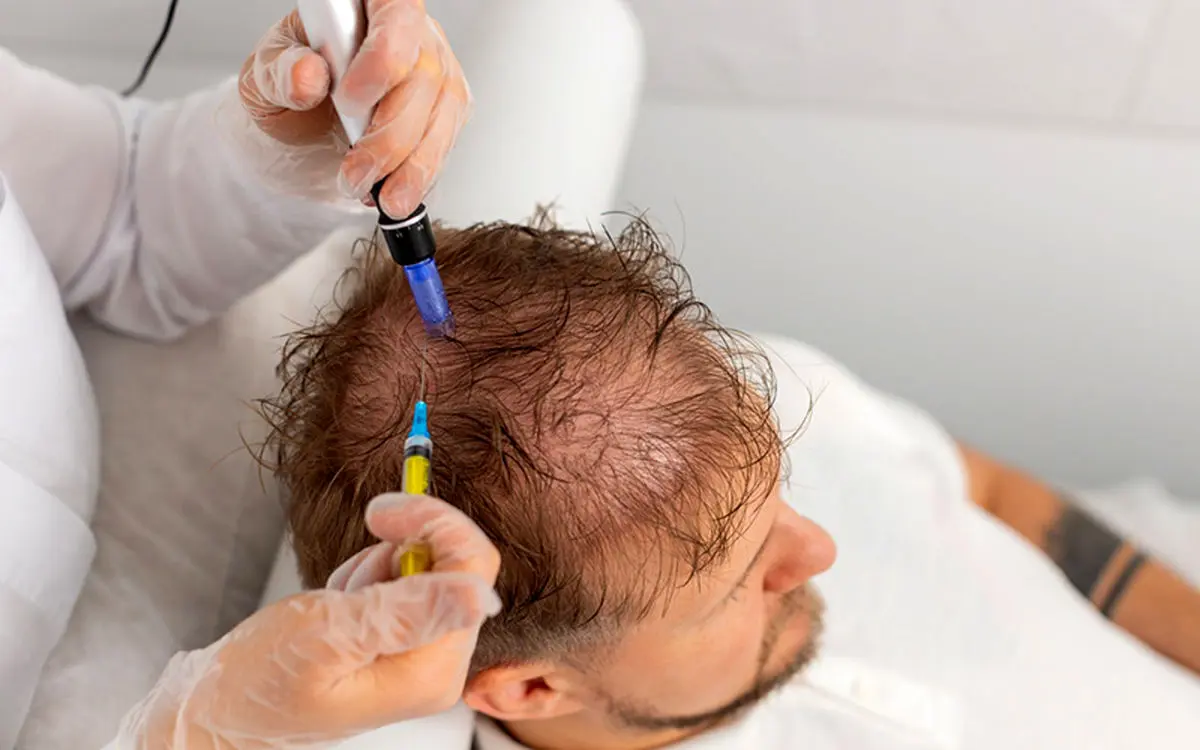 راز رویش دوباره موها با اگزوزوم؛ وقتی علم و زیبایی دست در دست هم می‌دهند 