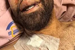 افراد حاضر در اغتشاشات این‌طوری کشته شدند